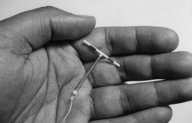 Image of a hand holding an IUD