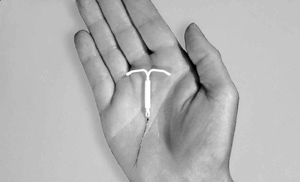 A hand holding a LNG-IUD