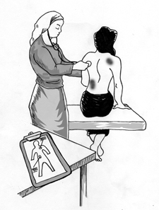 Nurse checking client's bruised back